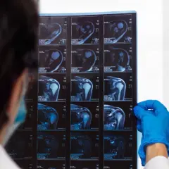 Lekarz w niebieskiej rękawiczce analizuje serię obrazów z rezonansu magnetycznego barku, badając szczegółowo strukturę stawu.