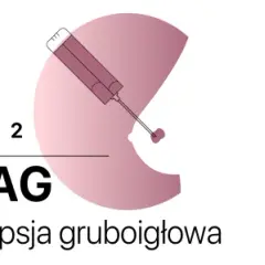 Trzy rodzaje biopsji: cienkoigłowa (BAC), gruboigłowa (BAG) i mammotomiczna (MMT). BAG to biopsja gruboigłowa, często stosowana przy BIRADS 4.
