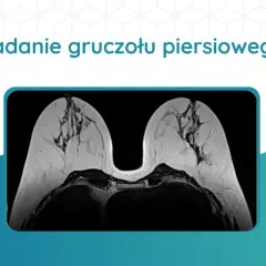 Badanie gruczołu piersiowego: przekrój rezonans klatki piersiowej ukazuje szczegółową budowę obu piersi.
