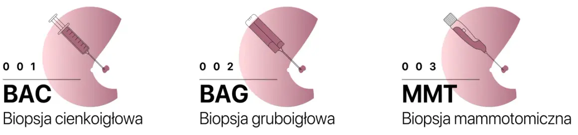 Trzy rodzaje biopsji: cienkoigłowa (BAC), gruboigłowa (BAG) i mammotomiczna (MMT). BAG to biopsja gruboigłowa, często stosowana przy BIRADS 4.