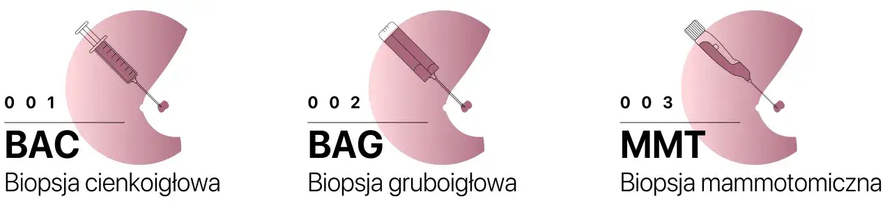 BI-RADS 4 i biopsja gruboigłowa piersi - co warto wiedzieć