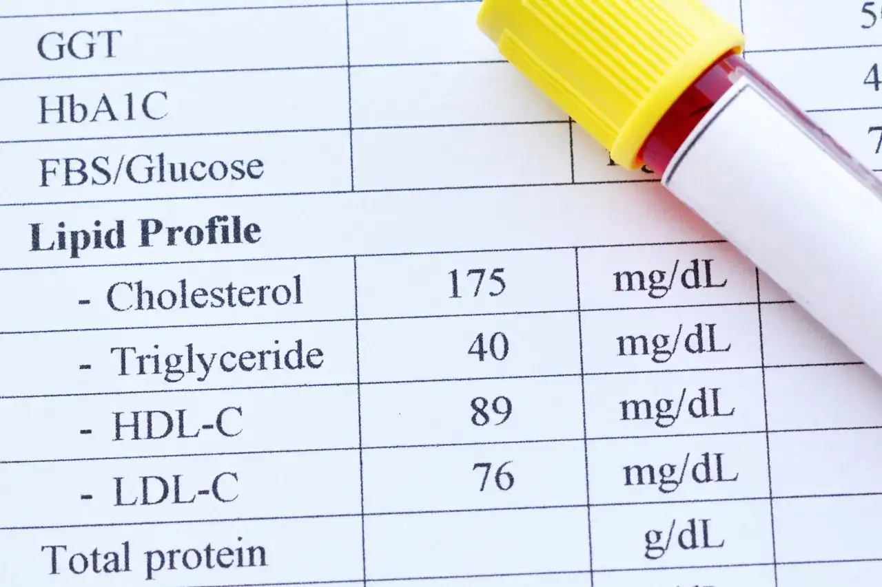 Normy cholesterolu i lipidogramu - jak czytać wyniki?