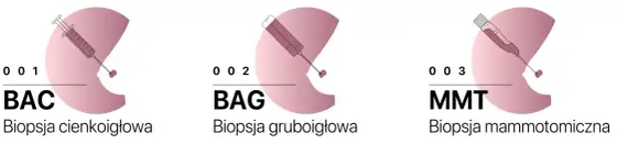 BI-RADS 4 i biopsja gruboigłowa piersi - co warto wiedzieć