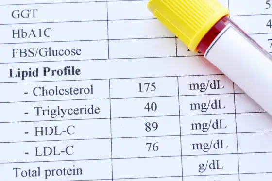 Normy cholesterolu i lipidogramu - jak czytać wyniki?